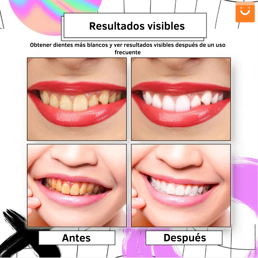 ⚡ Oferta Flash | AngelSmile™- Pasta de dientes en mousse morada blanqueadora