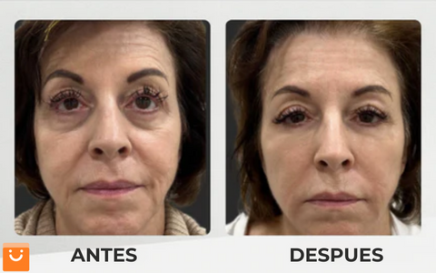 LimeTow™ - CREMA REAFIRMANTE INSTANTÁNEA PARA OJOS