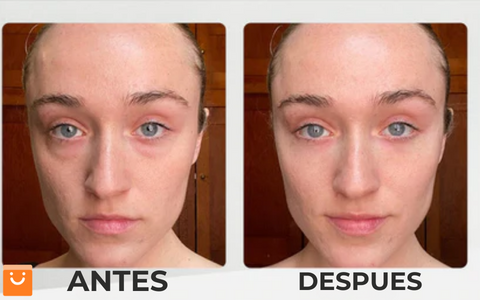 LimeTow™ - CREMA REAFIRMANTE INSTANTÁNEA PARA OJOS