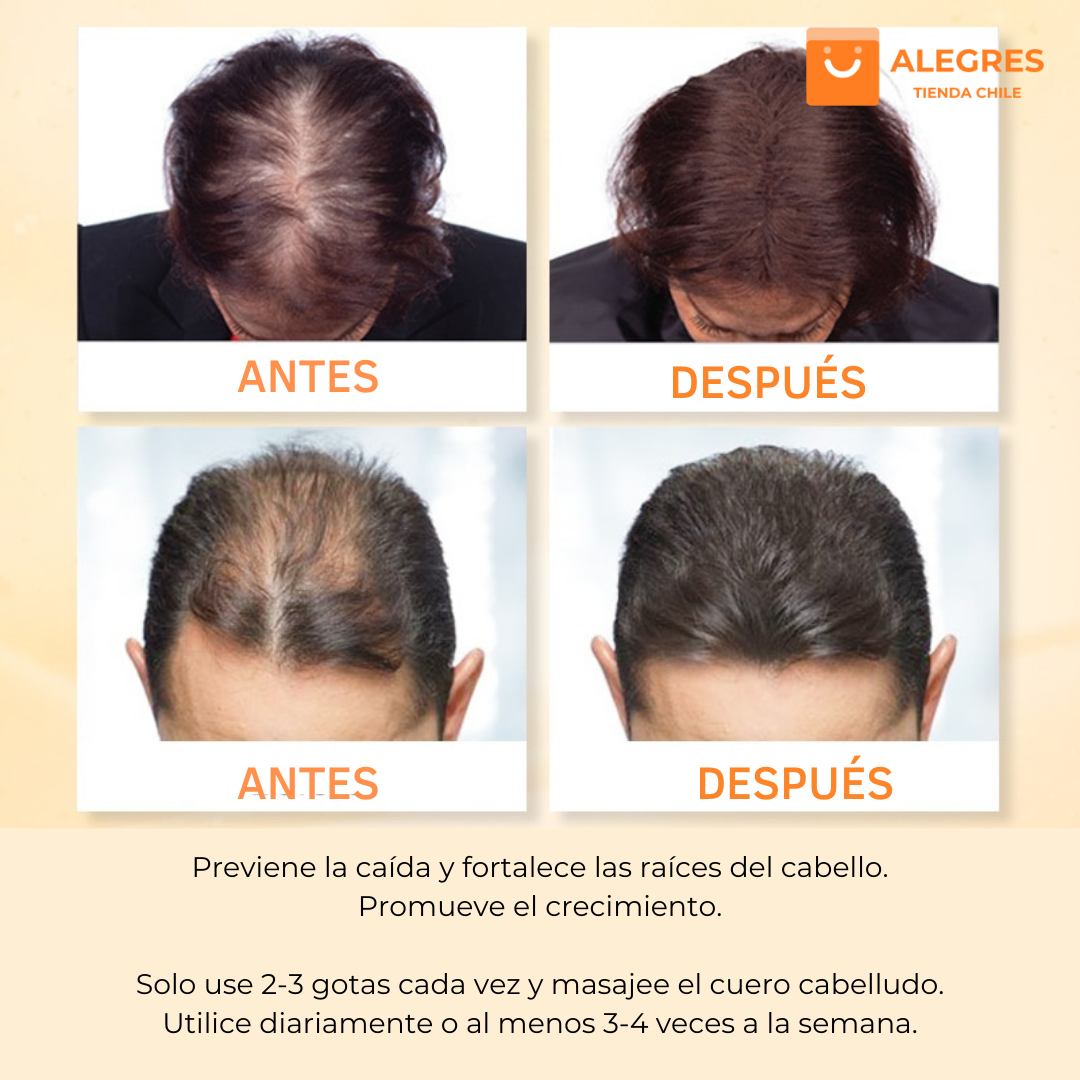 Purc™ - Aceite esencial para el crecimiento del cabello