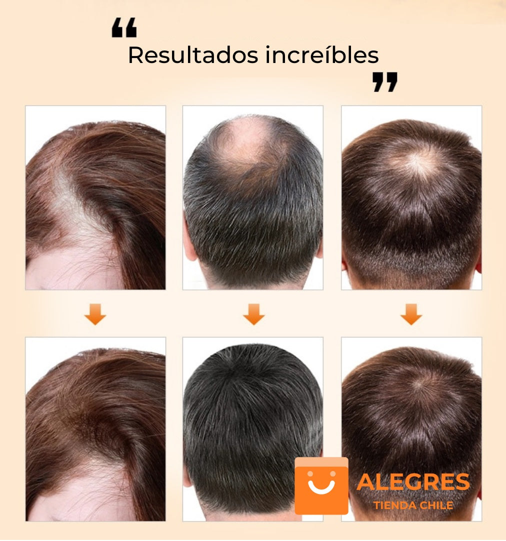 Purc™ - Aceite esencial para el crecimiento del cabello