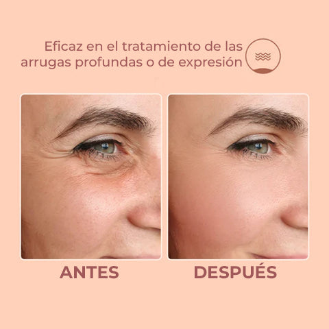 SkinSculptor™ - Bálsamo facial anti arrugas