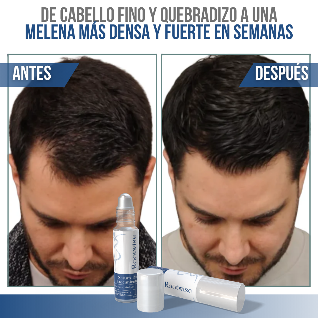 Rootwise™ - Recupera tu cabello, fortalece tu confianza