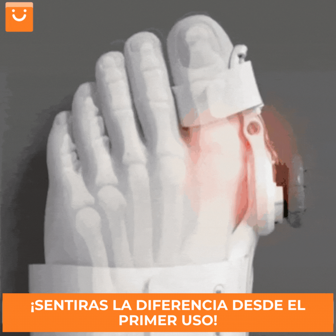 HALLUXCARE™ - CORRECTOR DE JUANETES