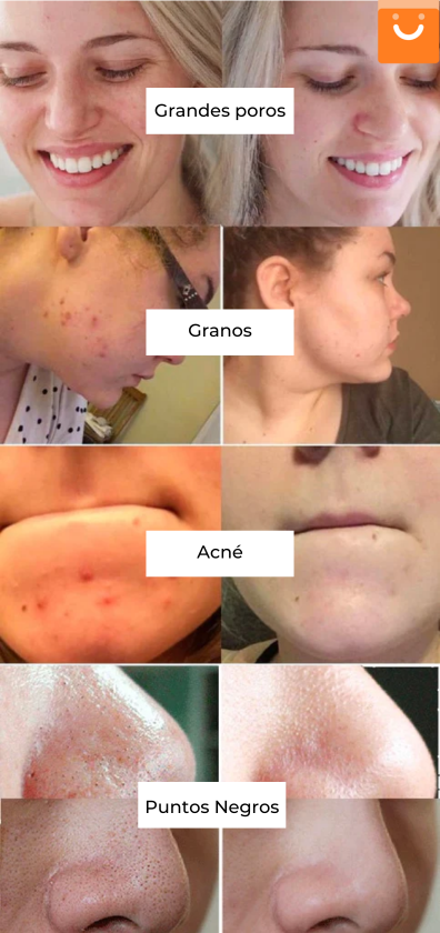 CleanFace™- Suero limpiador en espuma