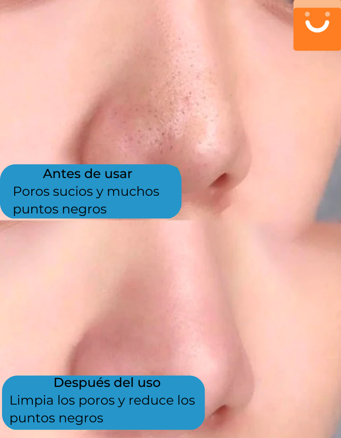 CleanFace™- Suero limpiador en espuma