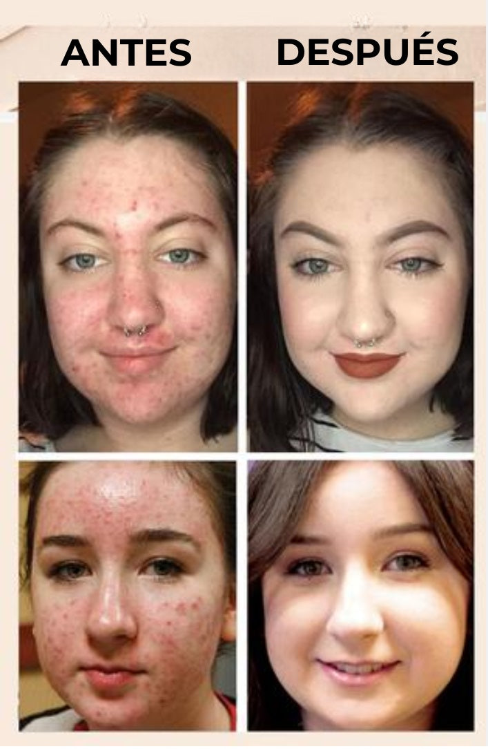 TIFITM™ - Corrector de maquillaje para rostro tricolor
