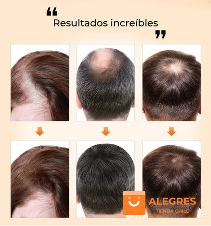 Purc™ - Aceite esencial para el crecimiento del cabello
