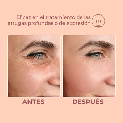 SkinSculptor™ - Bálsamo facial anti arrugas