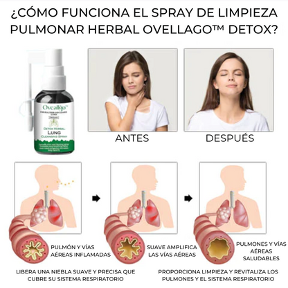 Oveallgo™ - Detox limpiador pulmonar a base de hierba