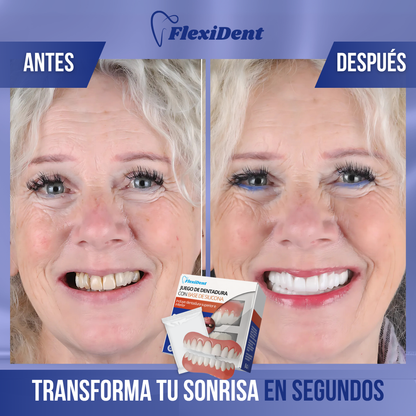 FlexiDent™ - Recupera tu sonrisa al instante