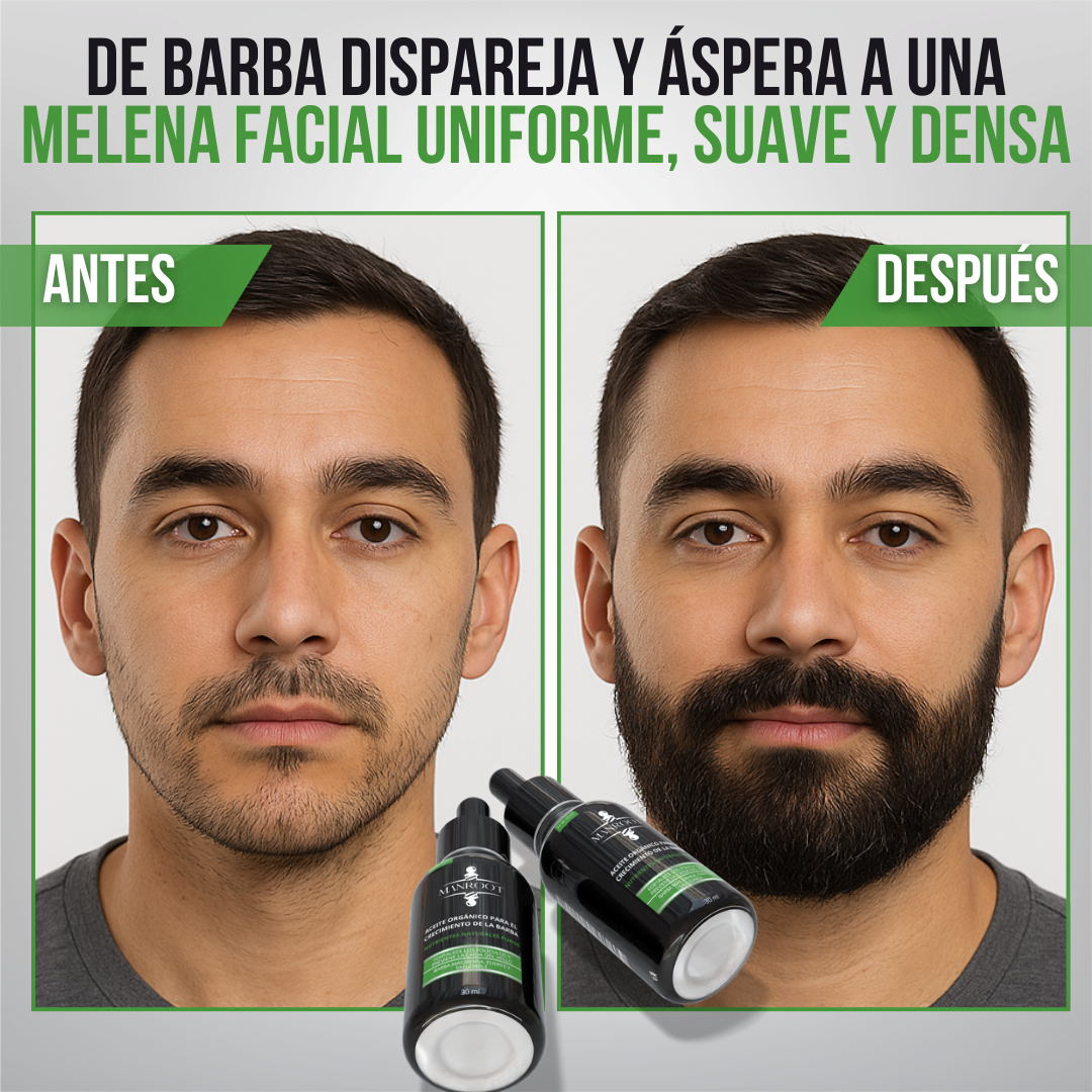 Manroot™ - Barba más densa, fuerte y saludable, naturalmente