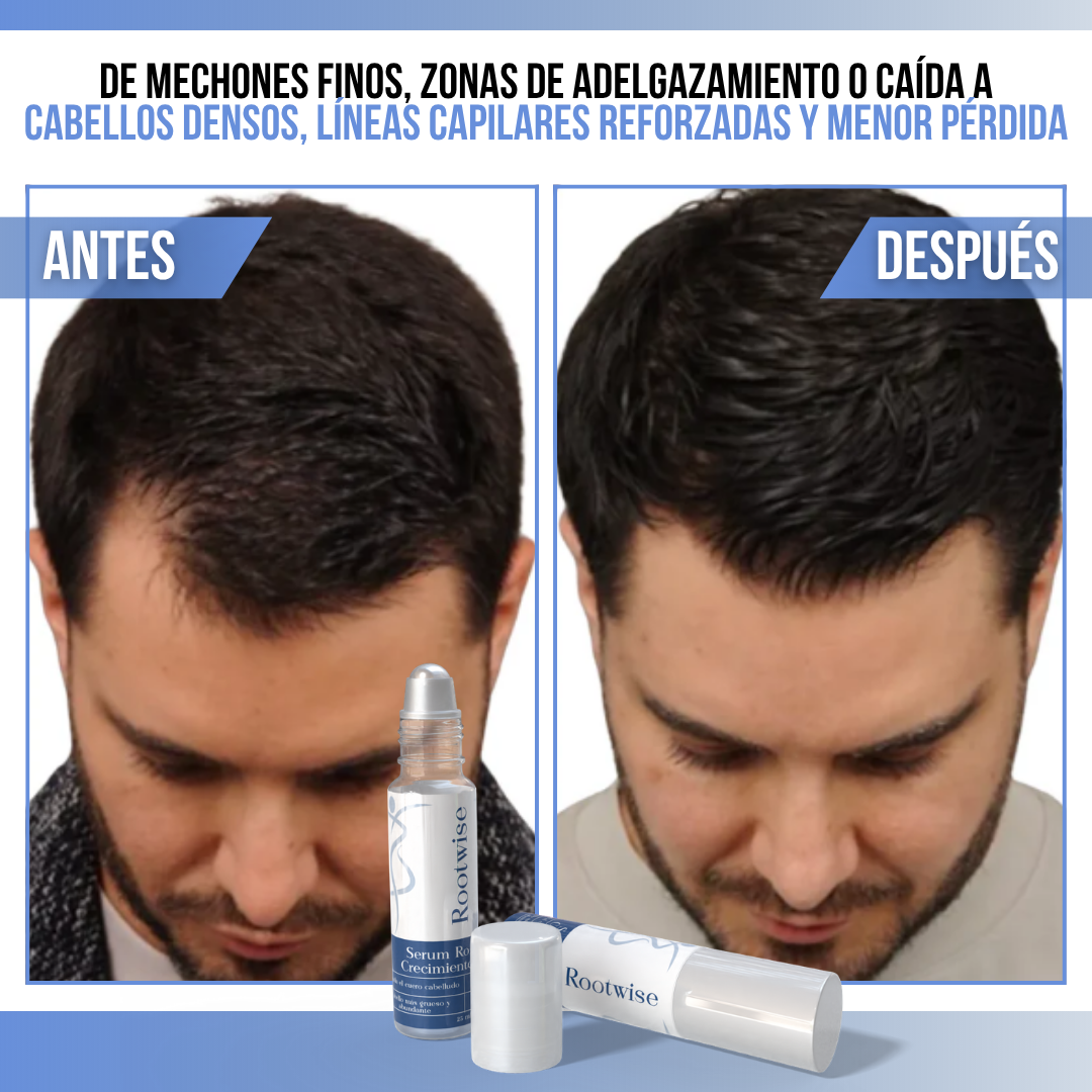 Rootwise™ - Cabello más fuerte desde la raíz