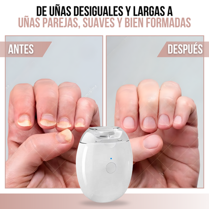 Nail Soft Pro™ - cuidado delicado para uñas pequeñas y grandes