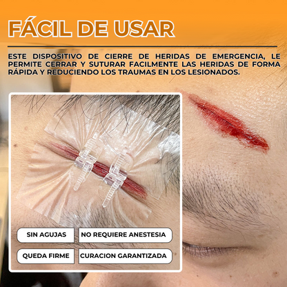 SWITFSEW™ - KIT PARA SUTURA DE HERIDAS