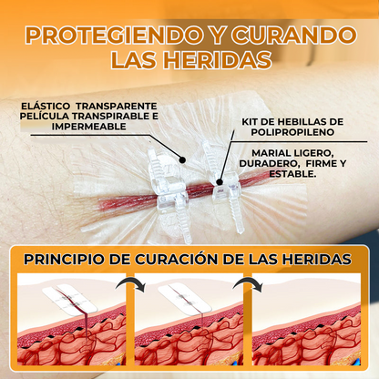 SWITFSEW™ - KIT PARA SUTURA DE HERIDAS