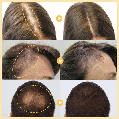 Purc™ - Aceite esencial para el crecimiento del cabello
