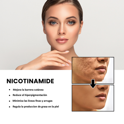NiaRadiante™ - Suero suavizante de la piel