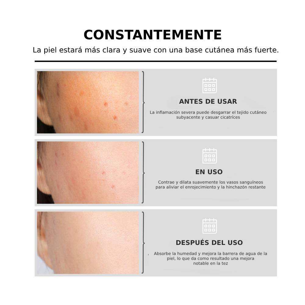 NiaRadiante™ - Suero suavizante de la piel