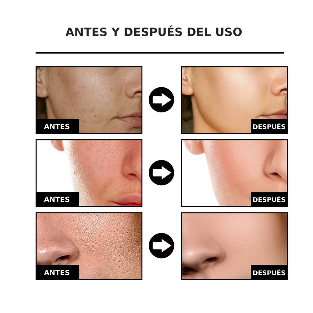 NiaRadiante™ - Suero suavizante de la piel
