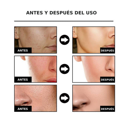 NiaRadiante™ - Suero suavizante de la piel