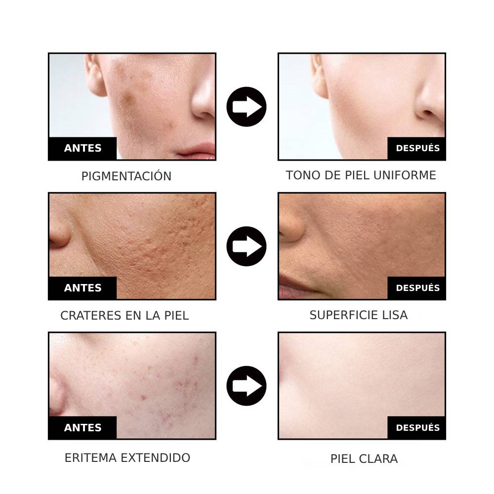 NiaRadiante™ - Suero suavizante de la piel
