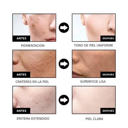 NiaRadiante™ - Suero suavizante de la piel