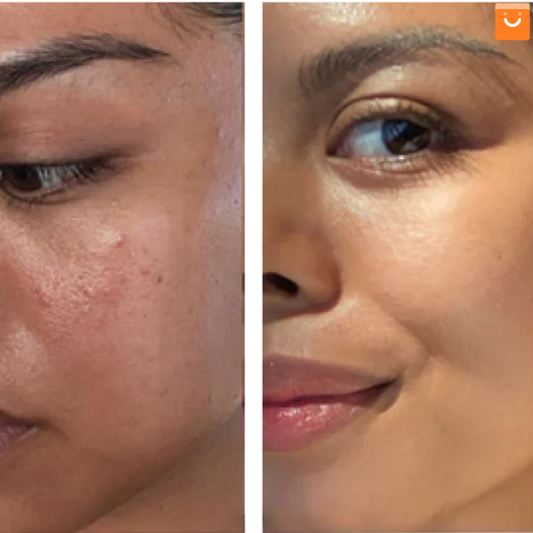 CleanFace™- Suero limpiador en espuma