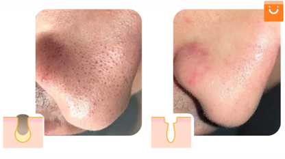 CleanFace™- Suero limpiador en espuma