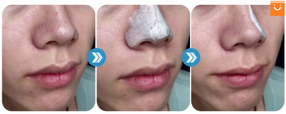 CleanFace™- Suero limpiador en espuma